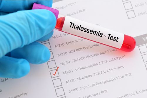 Want To Know About Beta Ce B2 Thalassemia Screening And Prenatal ...