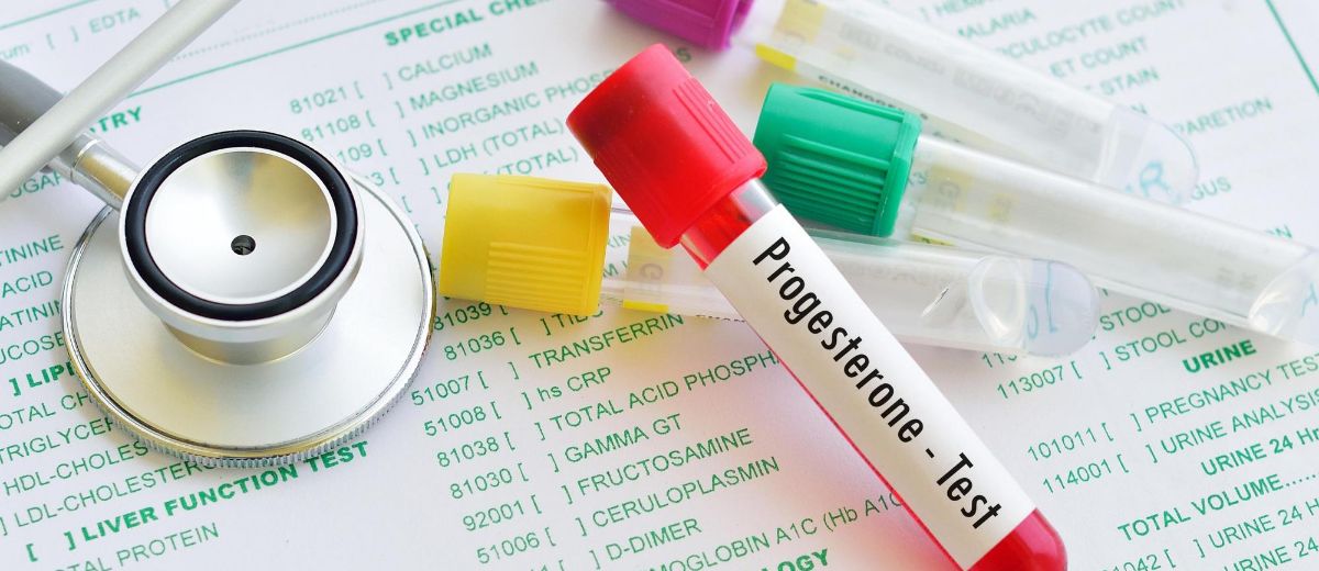 Progesterone visual data 6