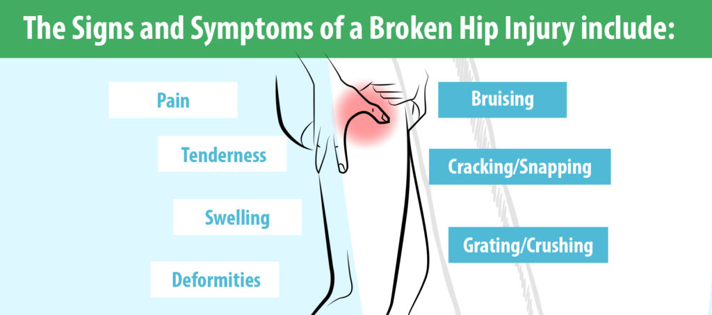 Sign and symptoms of a broken hip injury