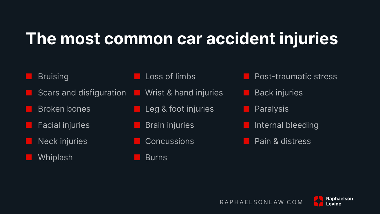 17 Most Common Car Accident Injuries - 631114a526fdac70b87db435 Most%20common%20car%20accident%20injuries