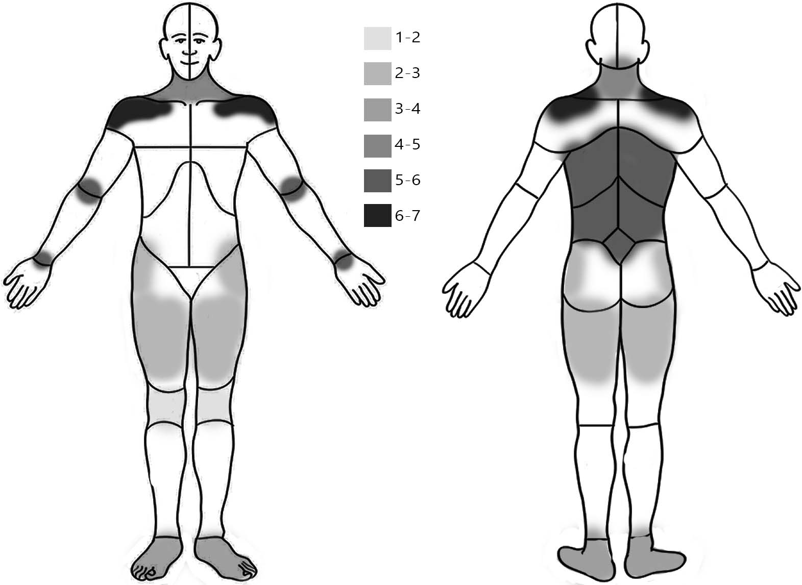 map of the body visualizing how bad pain is on a scale from 1-7