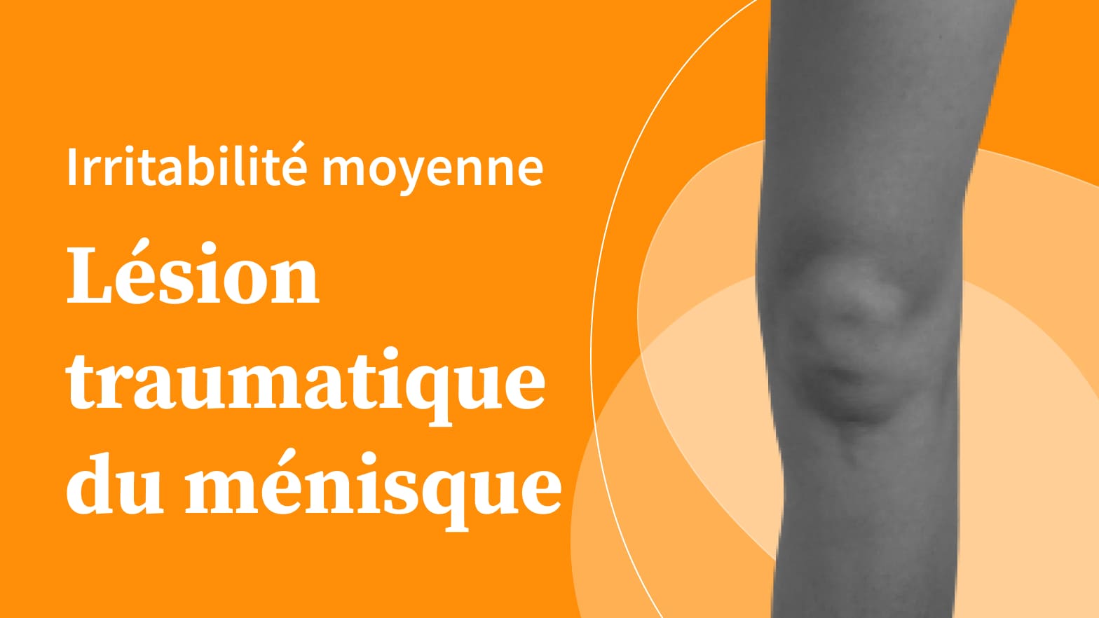 Fiche prescription d'exercices Lésion traumatique du ménisque