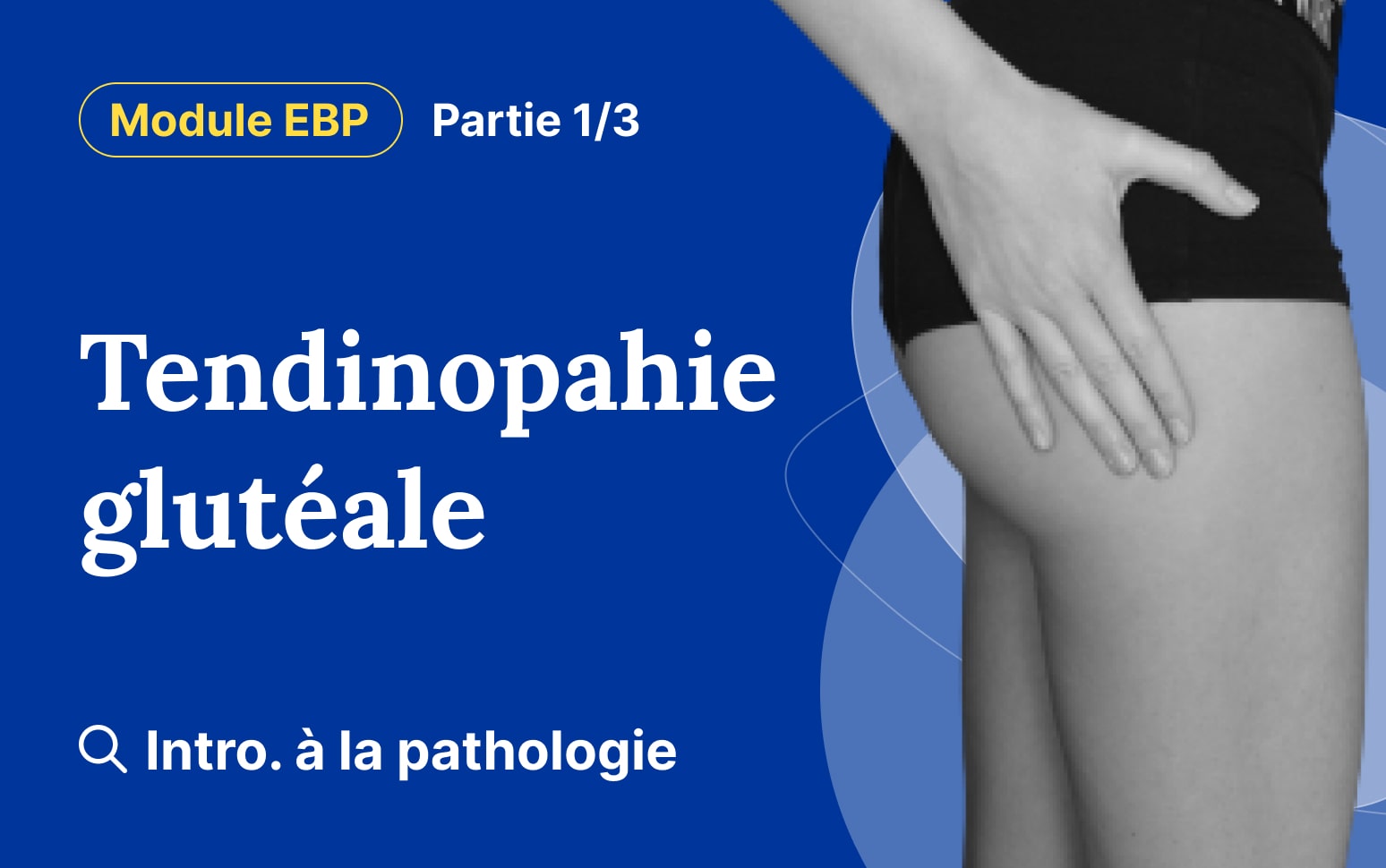 Module La tendinopathie glutéale Introduction à la pathologie