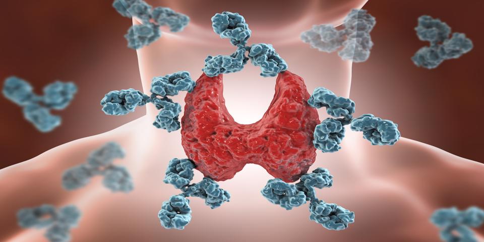 Hashimoto’s Disease