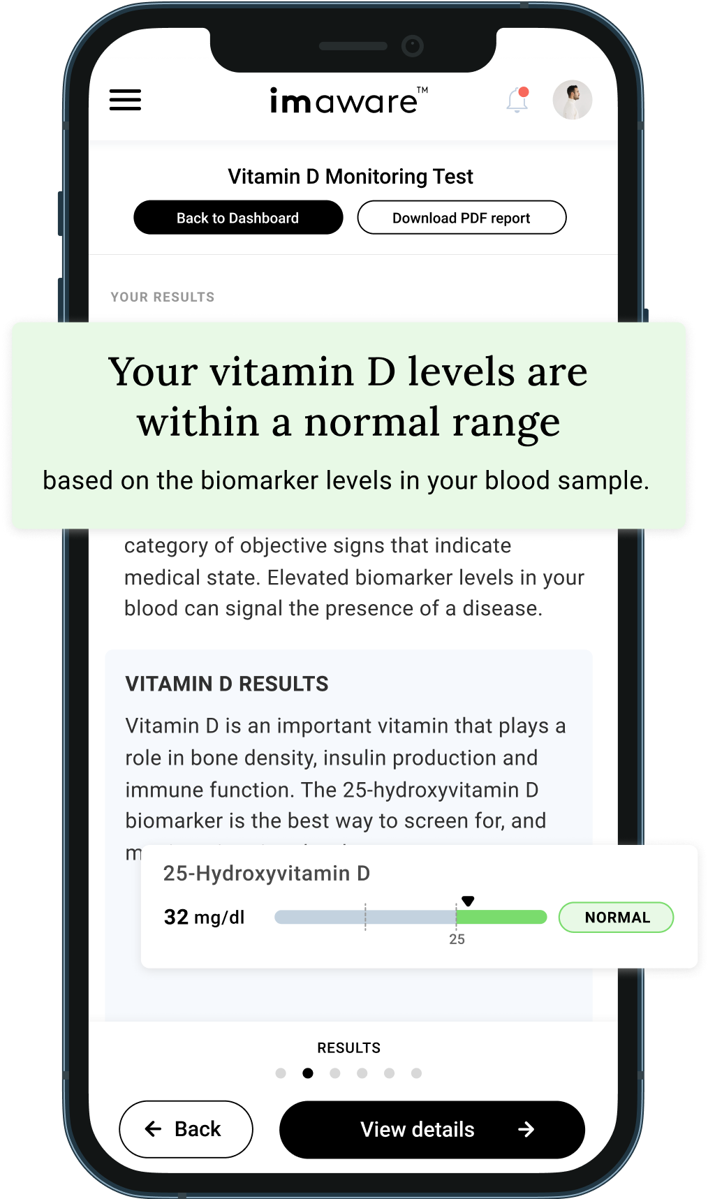 At Home Vitamin D Test Kit Doctor Reviewed 69 Imaware