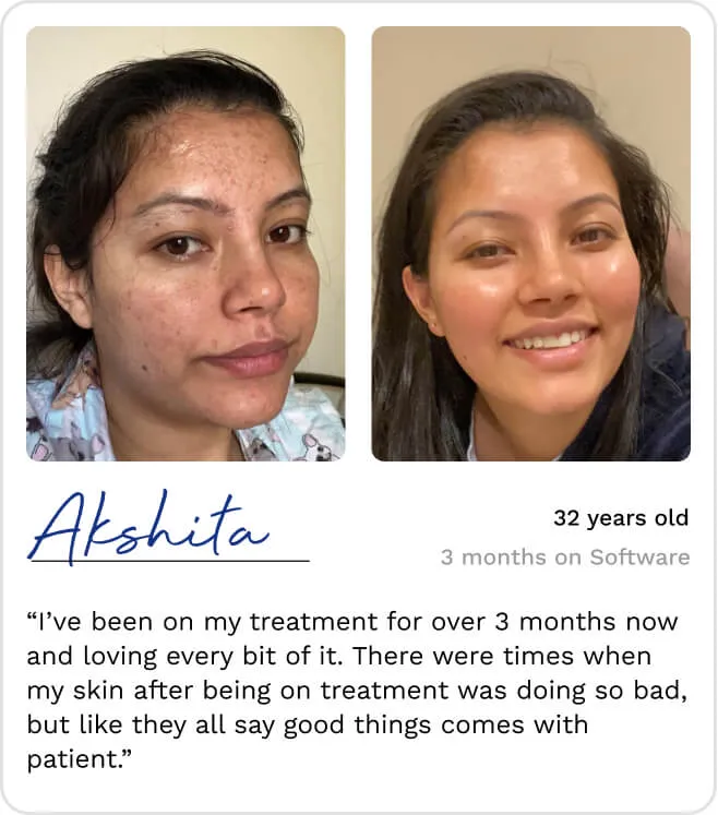 a before and after image displaying the product and a client testimonial