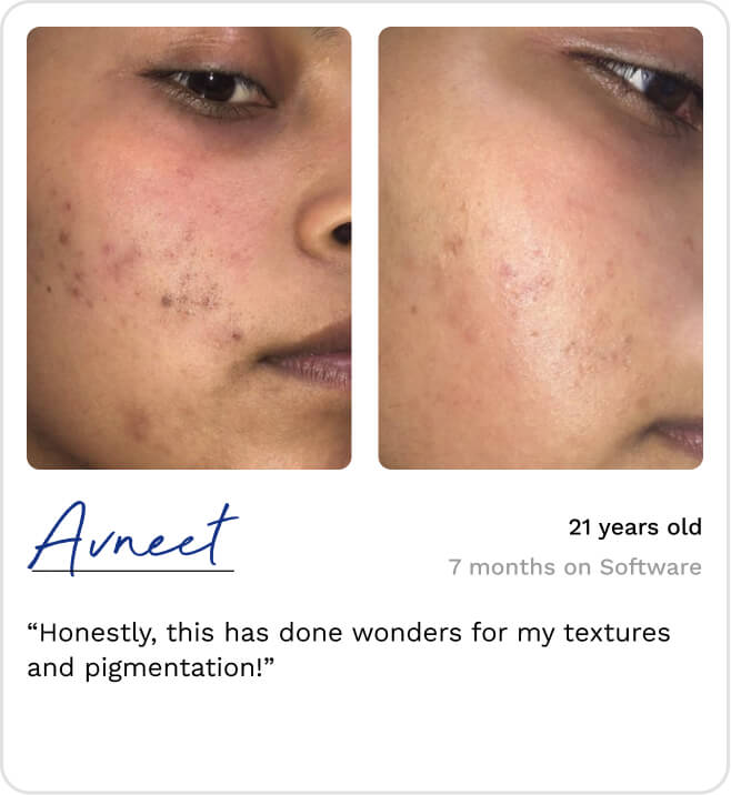 a before and after image displaying the product and a client testimonial