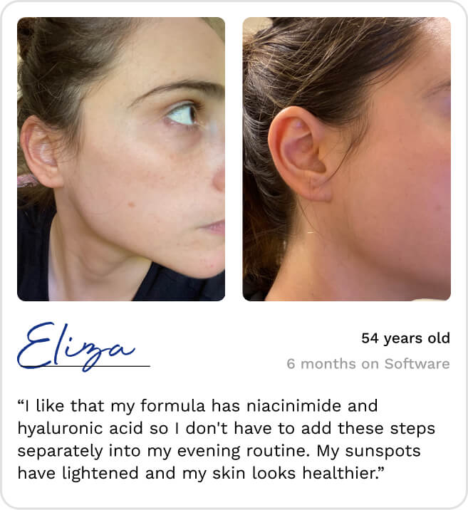a before and after image displaying the product and a client testimonial