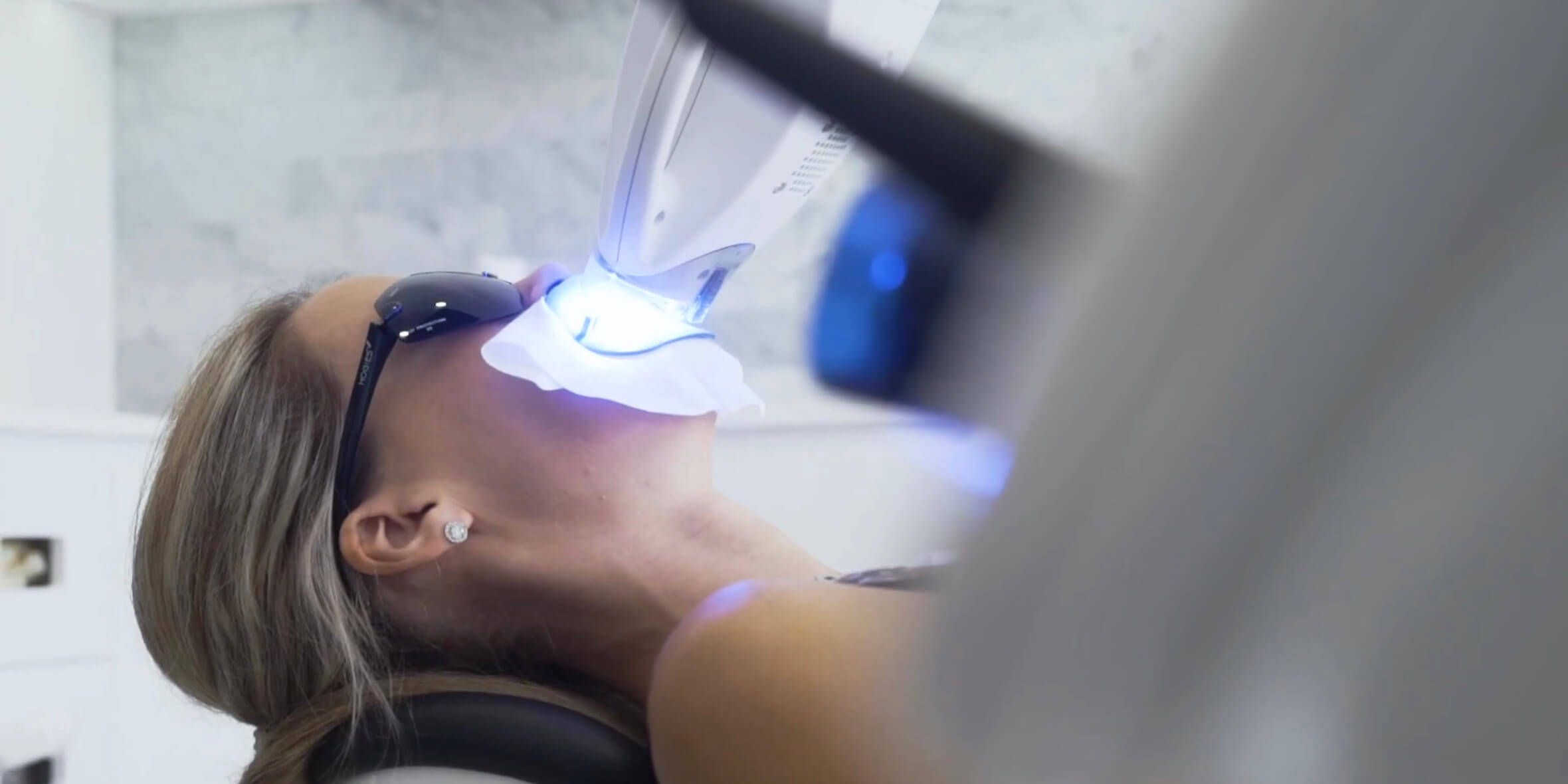 le tooth Brisbane Teeth Whitening