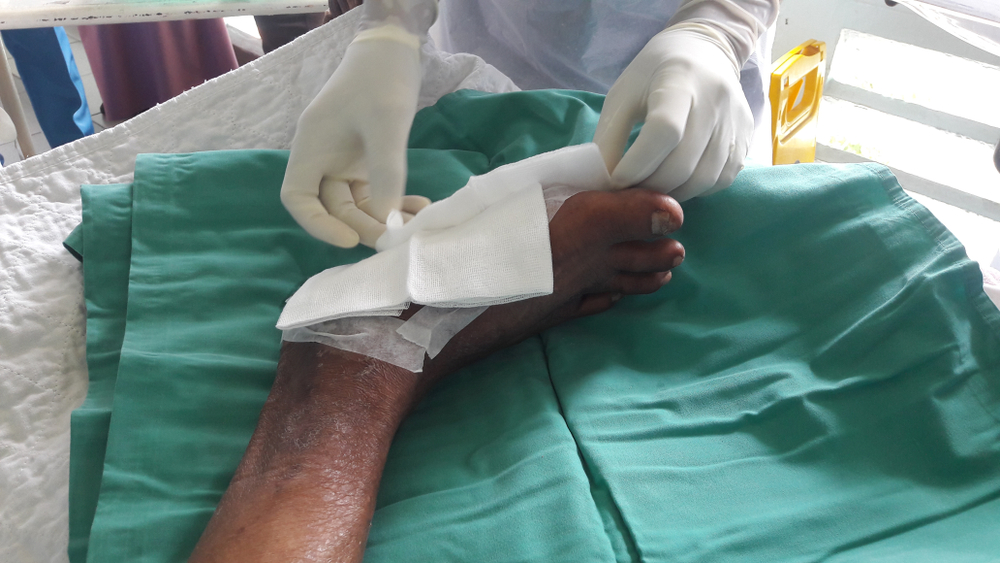Why Moist Environment Essential for Wound Healing Wound Healing