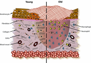 How the Concept of Aging in Wound Care Affects Clinical Treatment and ...