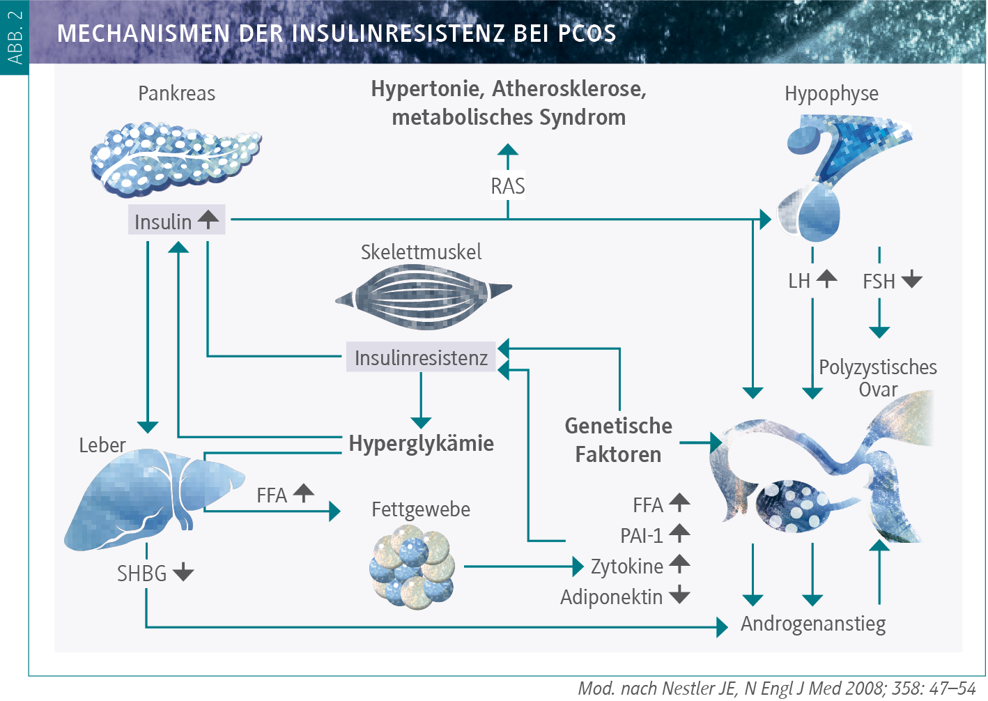 Evidenzbasiertes Management des polyzystischen Ovarsyndroms