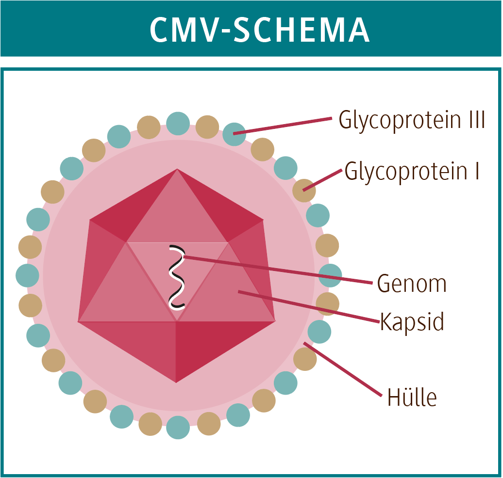 CMV-Primärinfektion in der Schwangerschaft
