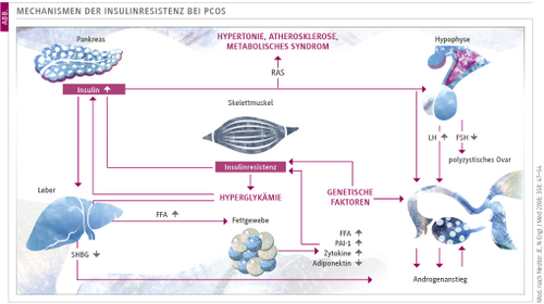 Diagnostik und Therapie des Polyzystischen Ovarsyndroms (PCOS) - DER PRIVATARZT DIGITAL