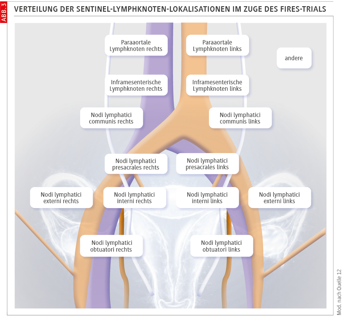 Robotische Operation des Endometriumkarzinoms