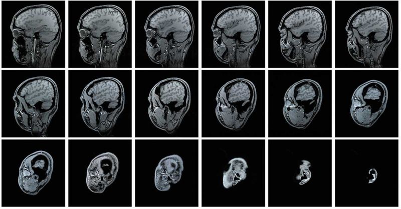 AI is helping doctors diagnose cancer, heart defects faster than ever ...