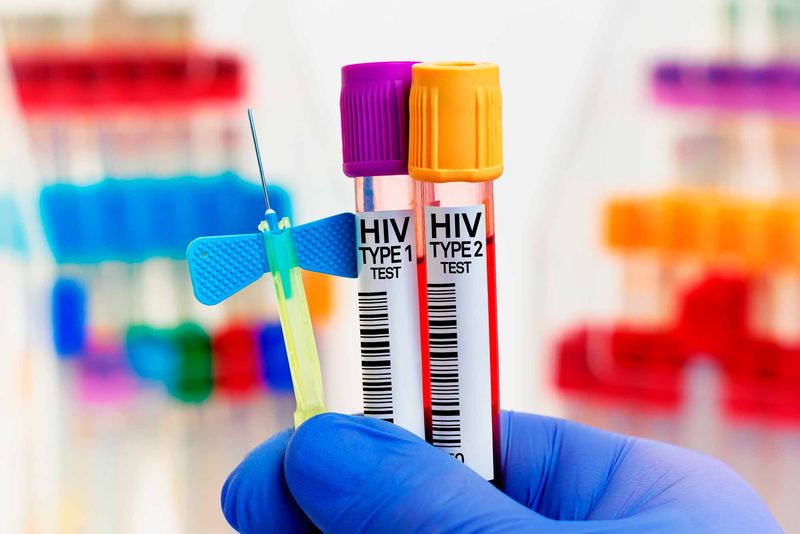 HIV 1 e 2: Entenda o que são e Principais Diferenças