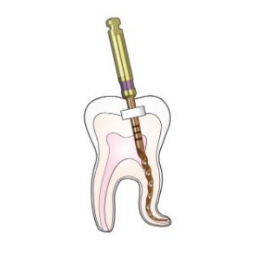DiaDent-DiaX-Rotary-Endodontic-Files