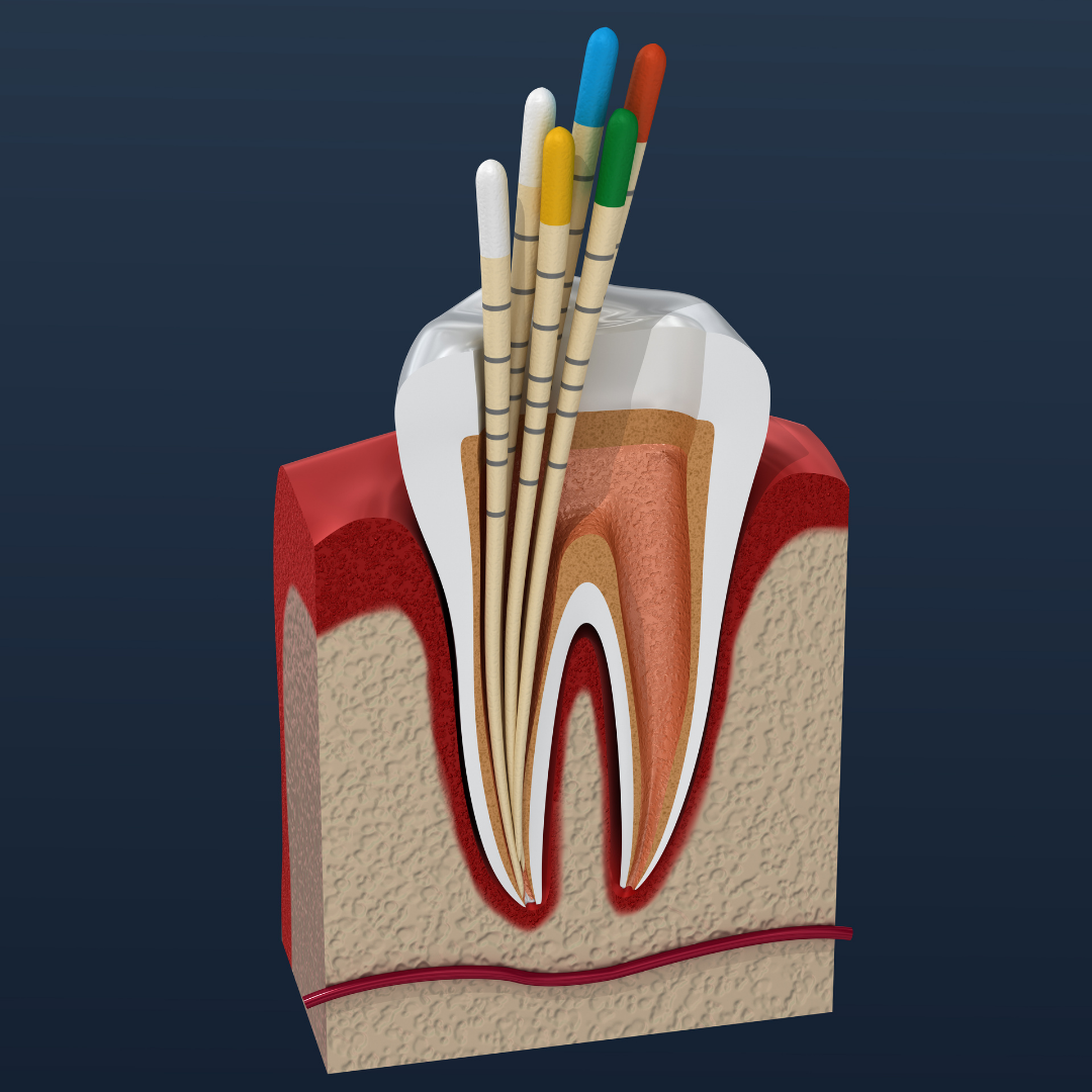 Best-Hands-On-Endodontic-Courses