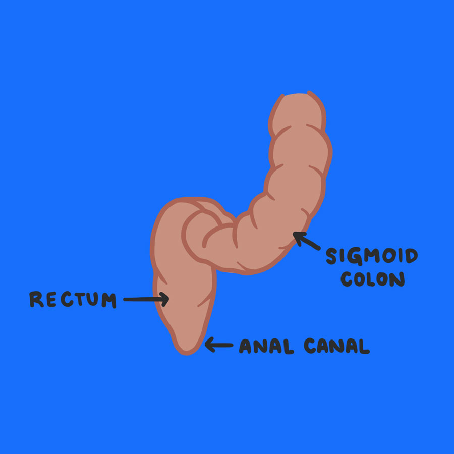 rectum, sigmoid colon and anal canal