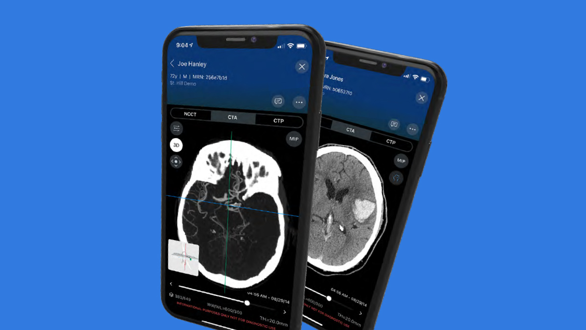 Coordinate care from the ambulance to the follow up visit. Learn more about how the Viz.ai Platform can transform your workflow.