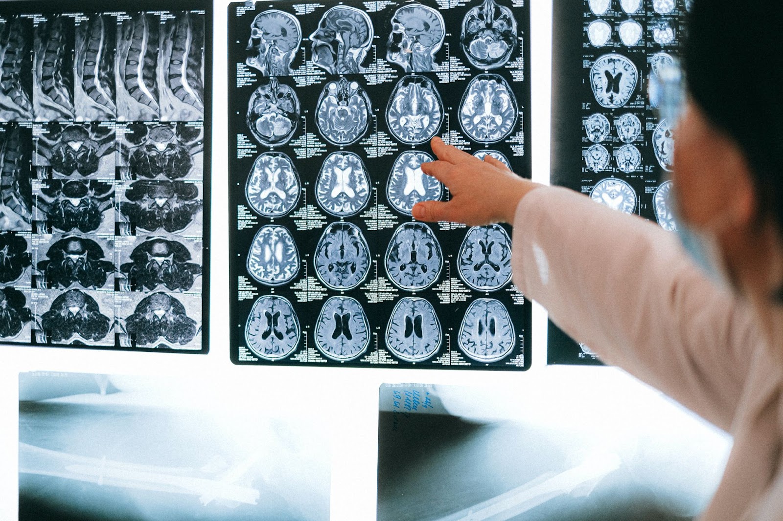 How to a Radiologist｜StepbyStep Guide