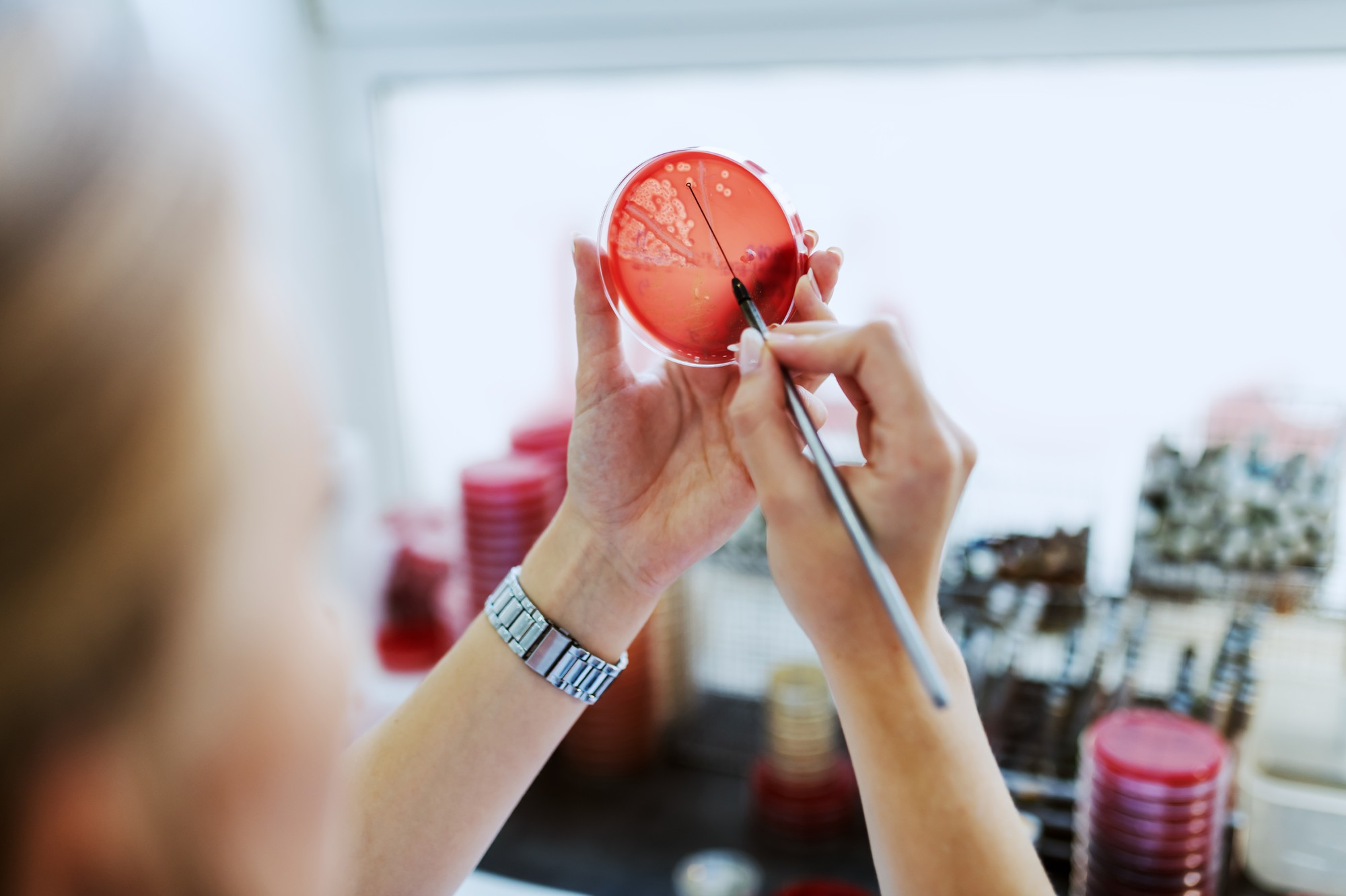 Scientist examining petri dish for mold growth