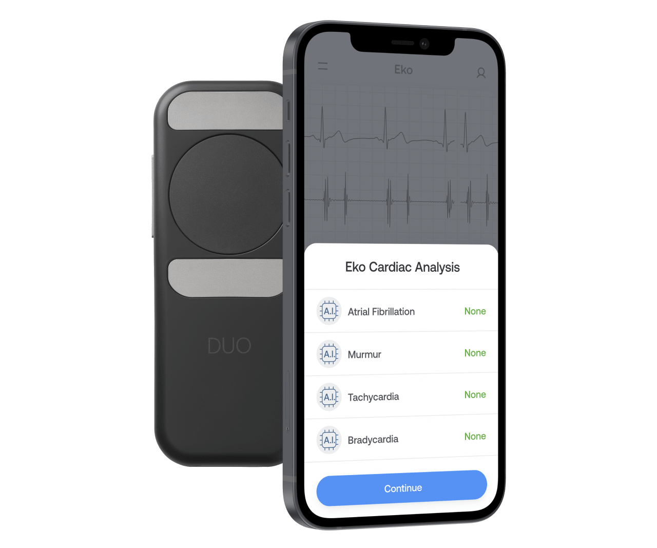 AIpowered Stethoscope, ECG & Telehealth Platform Eko