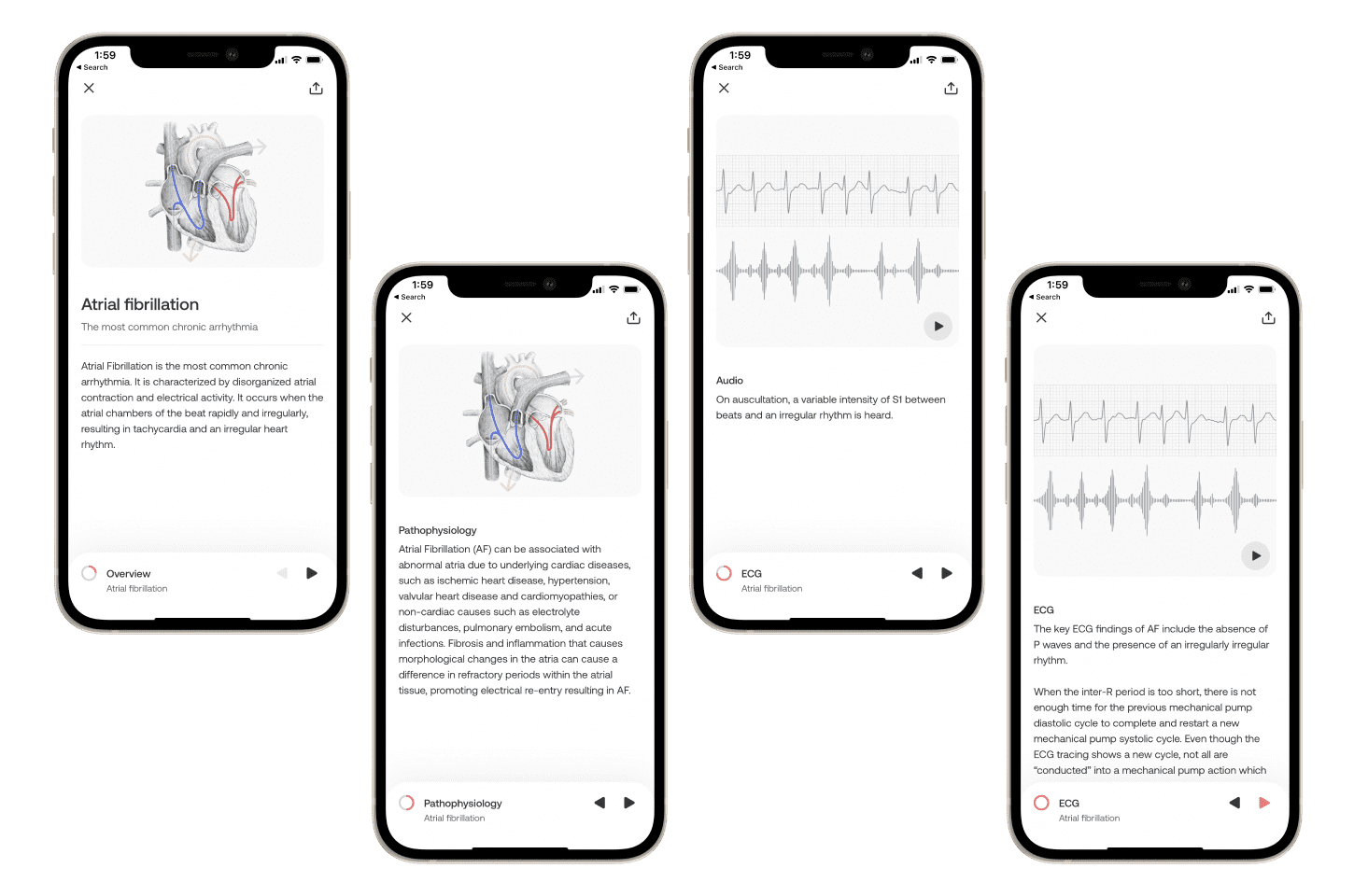 Learn Stethoscope & Auscultation Basics Eko Academy App