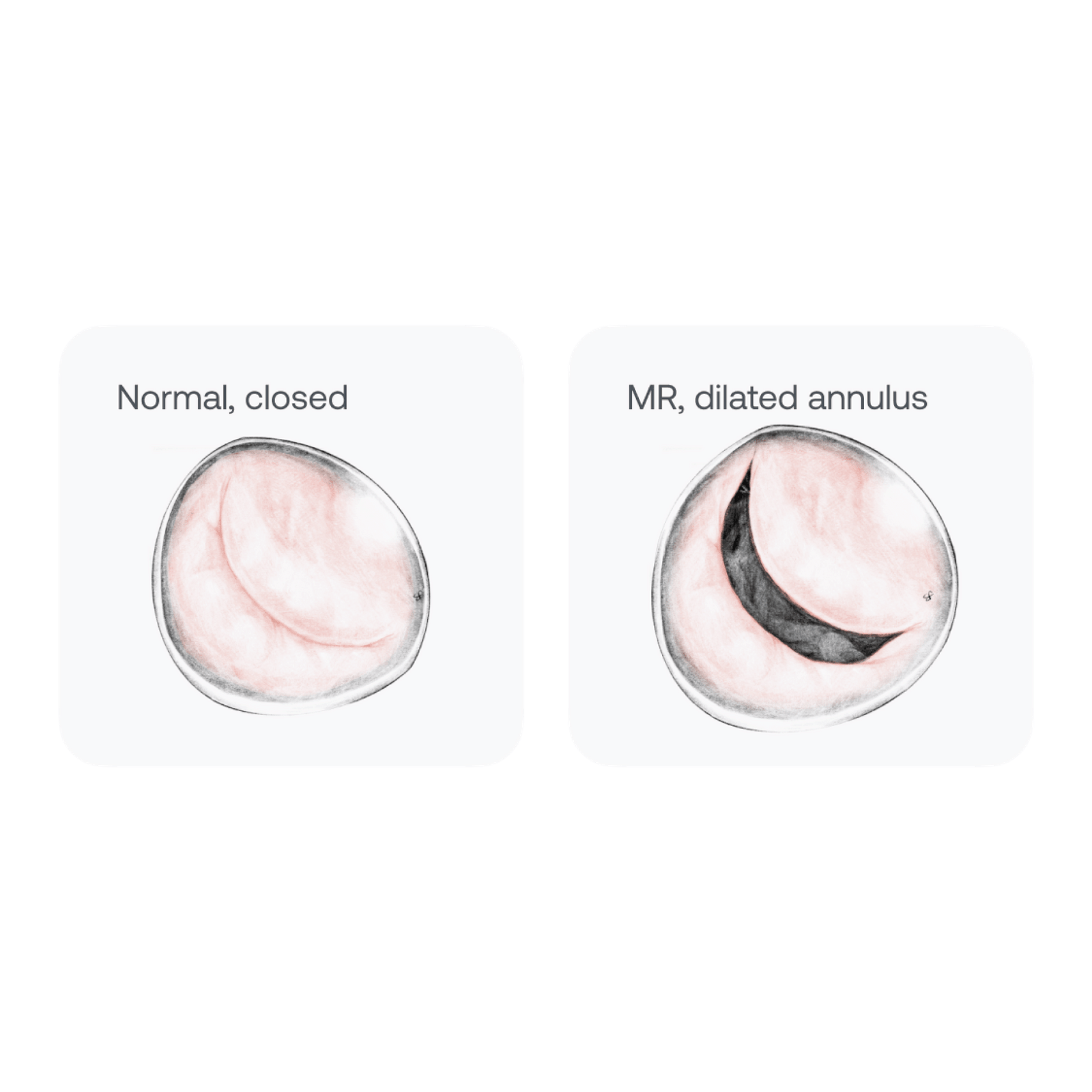 Case study of infection control mr jones nursing essay image
