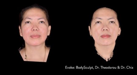 evoke-facesculpt1