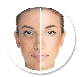 Hydrafacial in-article image
