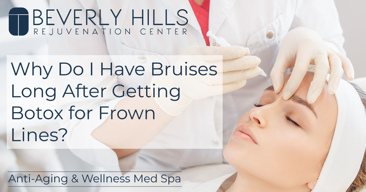Bruises From Botox Frown Line Injections BHRC Med Spa Blog