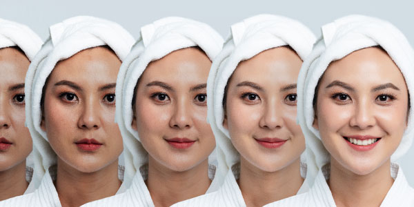 How To Treat Melasma Facial Pigmentation With Tri-Luma Cream