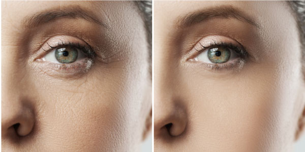 The Top 10 Anti-Aging Tips for 2016
