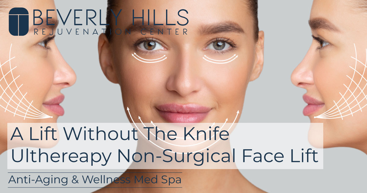 Ultherapy NonSurgical Face Lift BHRC Med Spa Blog