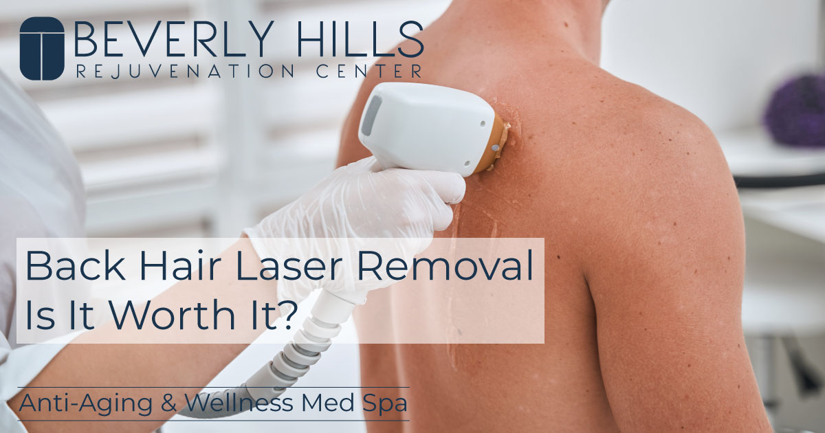 Is Back Hair Laser Removal Worth It? BHRC Med Spa Blog