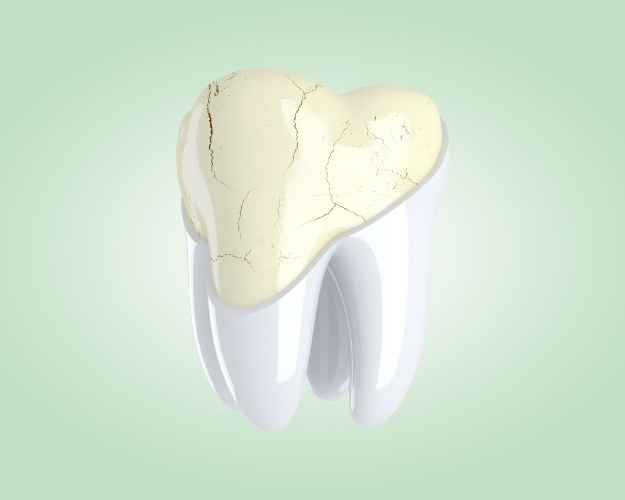 Can My Tooth Be Saved or Does It Need To Be Extracted?