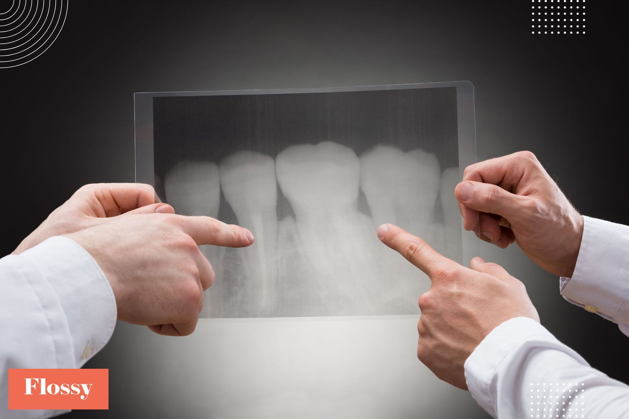 How Much Do Dental XRays Cost With & Without Insurance?