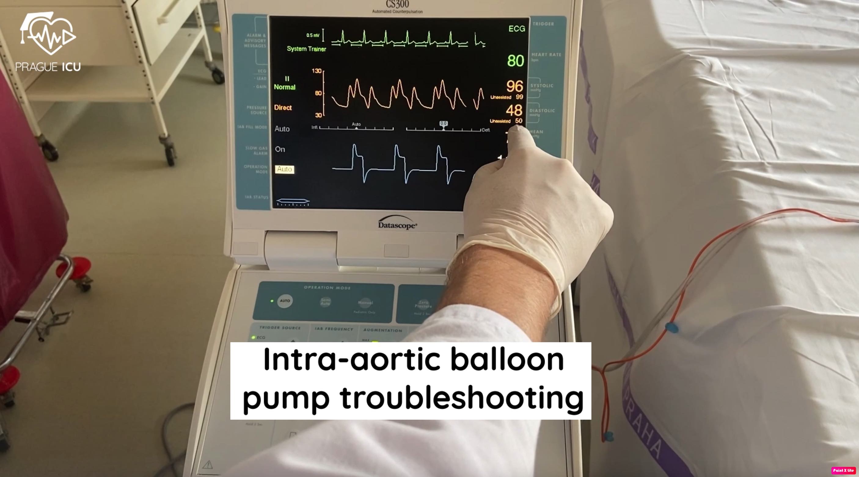 Workflow Blog: Intra-aortic balloon pump troubleshooting