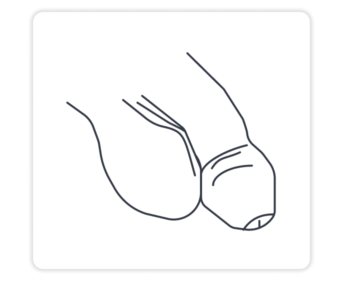 unerigierter penis | Spring