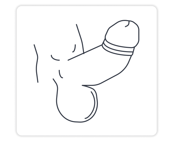 Steifer Penis | Spring