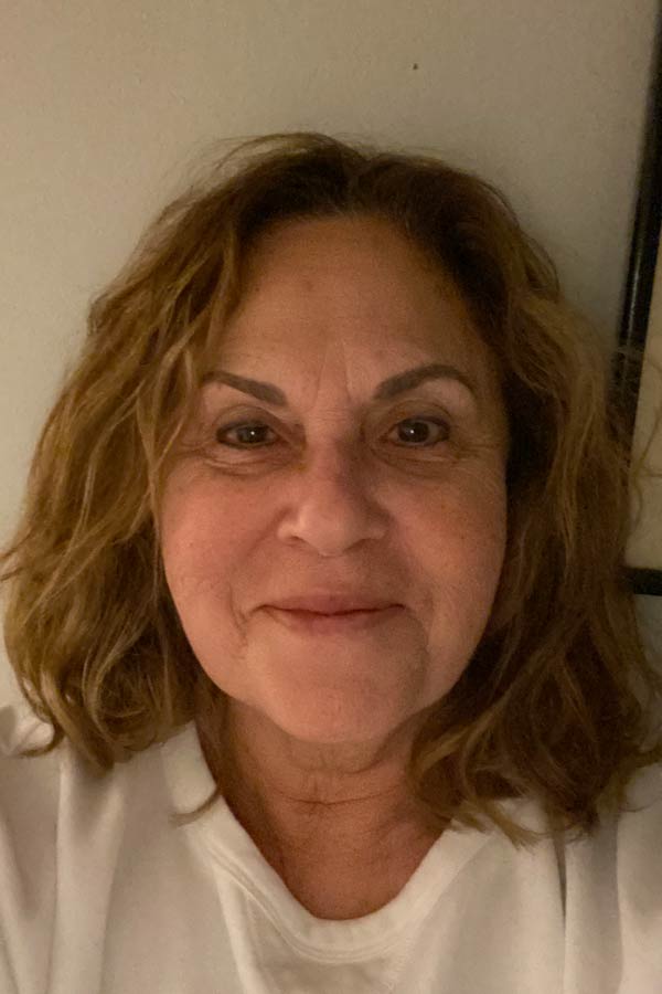 led light therapy before and after