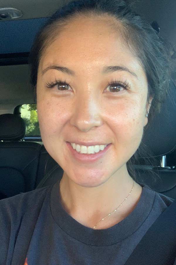 led light therapy review