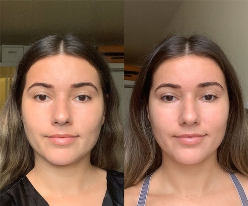 Red Light Therapy Before and After | SolaWave
