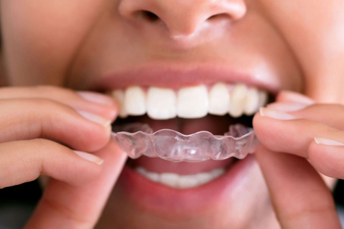 Understanding Sleep Apnea Teeth Grinding BlueSleep