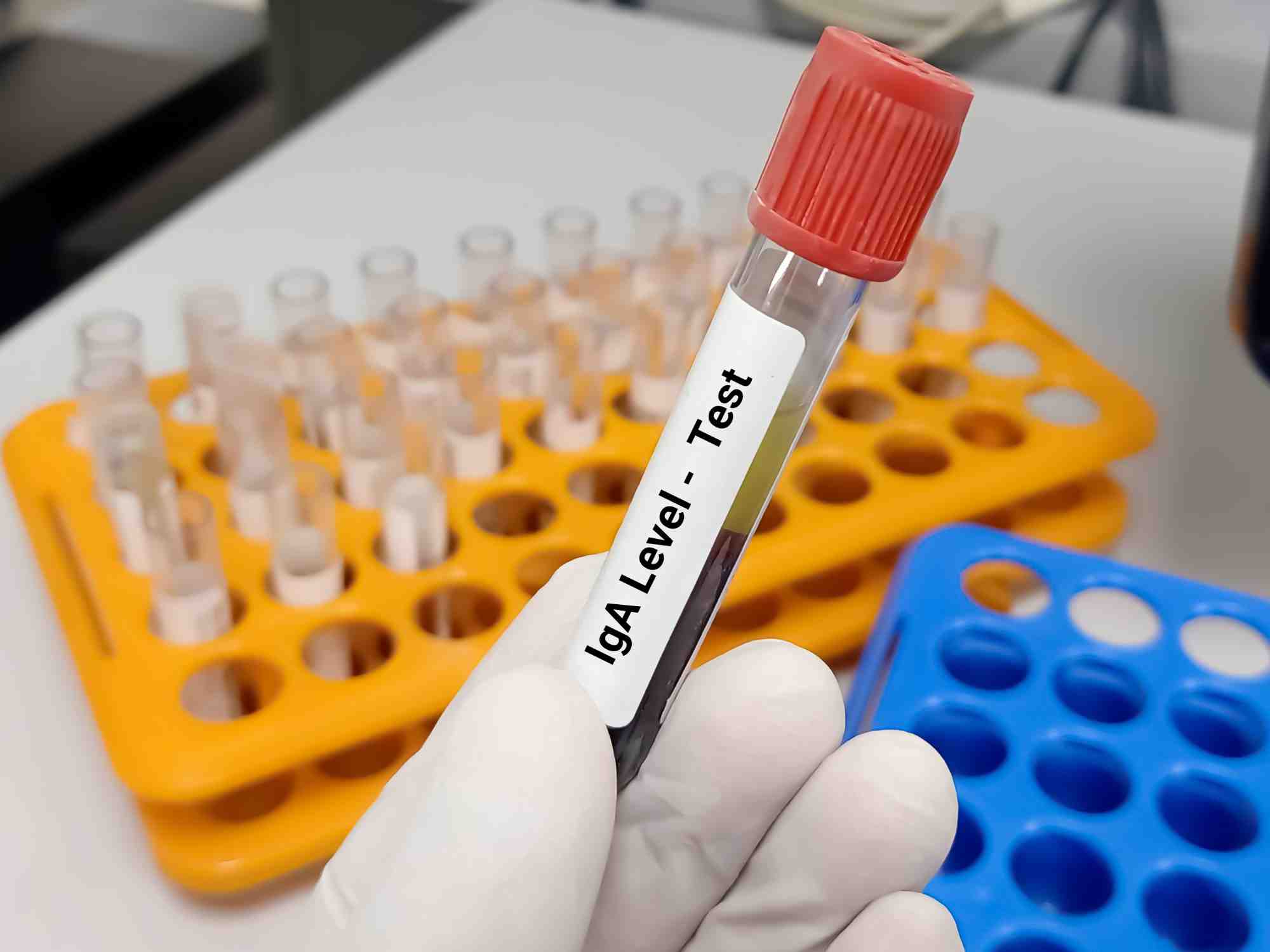 Immunoturbidimetric