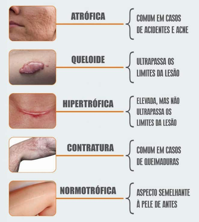Dermatologia Classifica o Das Les es Elementares Da Pele