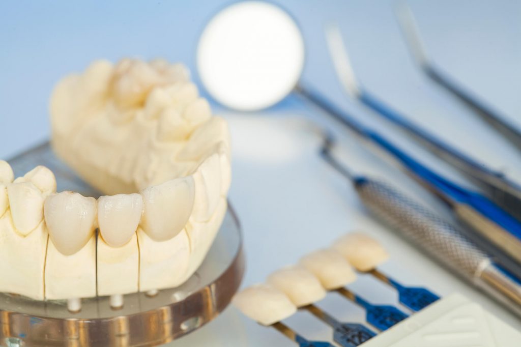 Can Cosmetic Dentistry Fix Receding Gums? Midtown Dental Studio