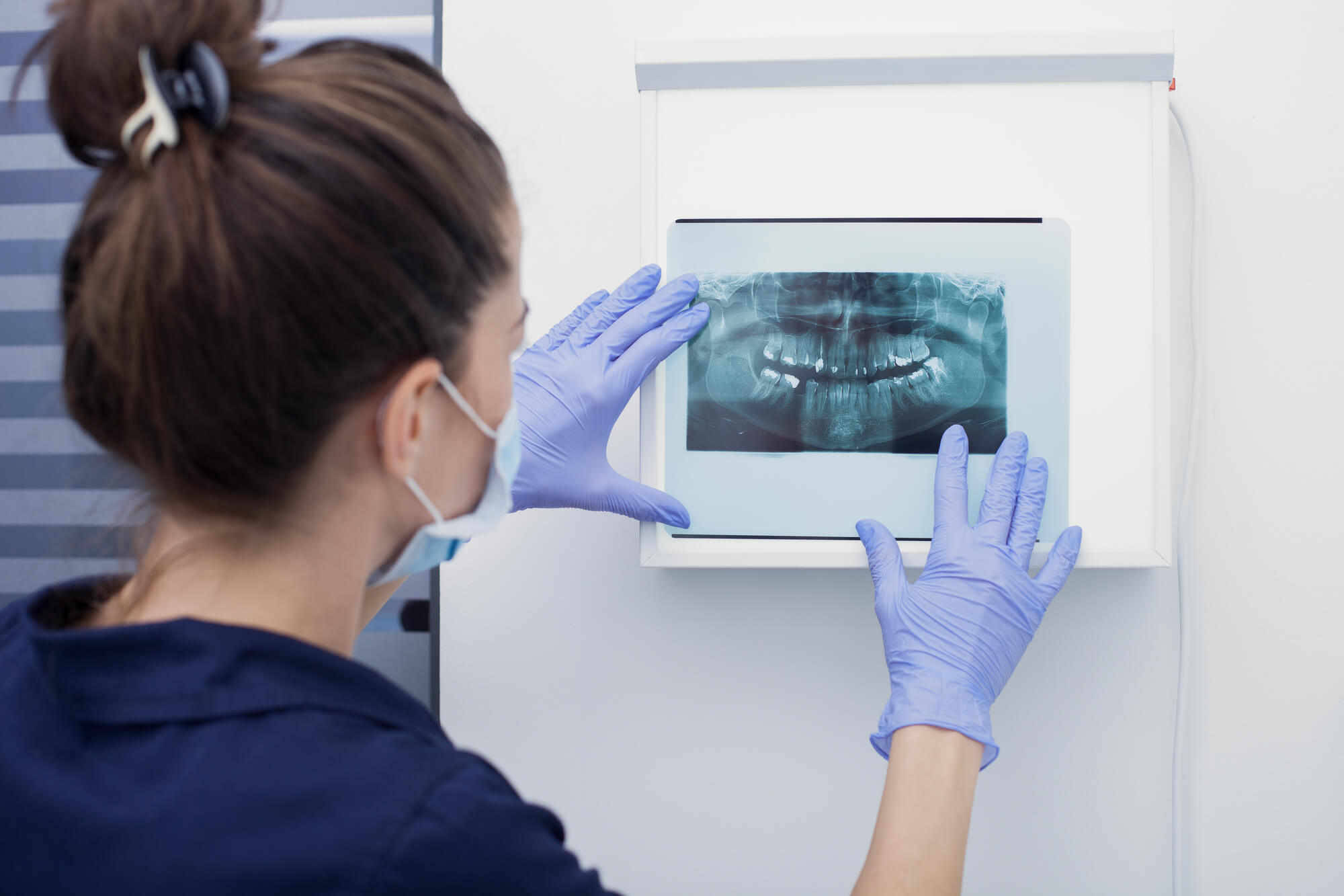 Why is Dental XRay Important? Midtown Dental Studio